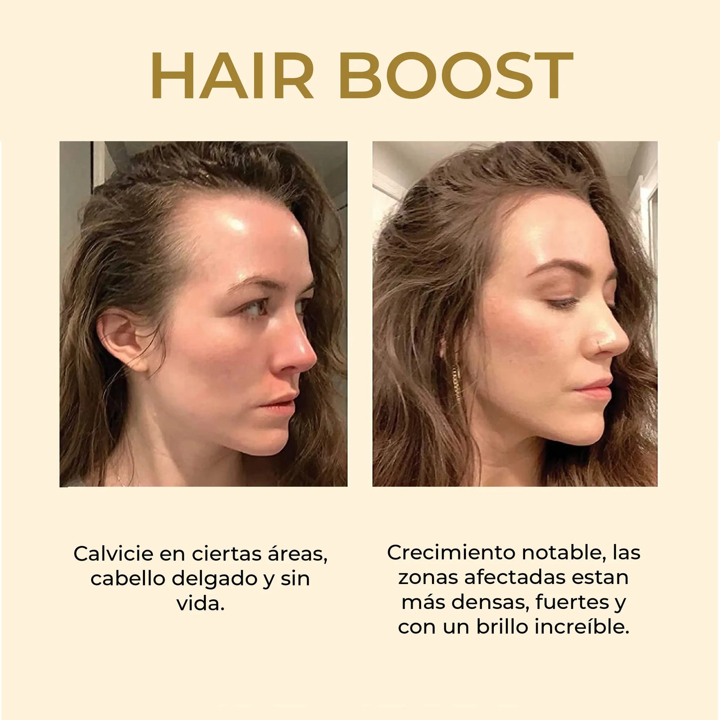 HairBoost: Crece, Fortalece y Anti Caida