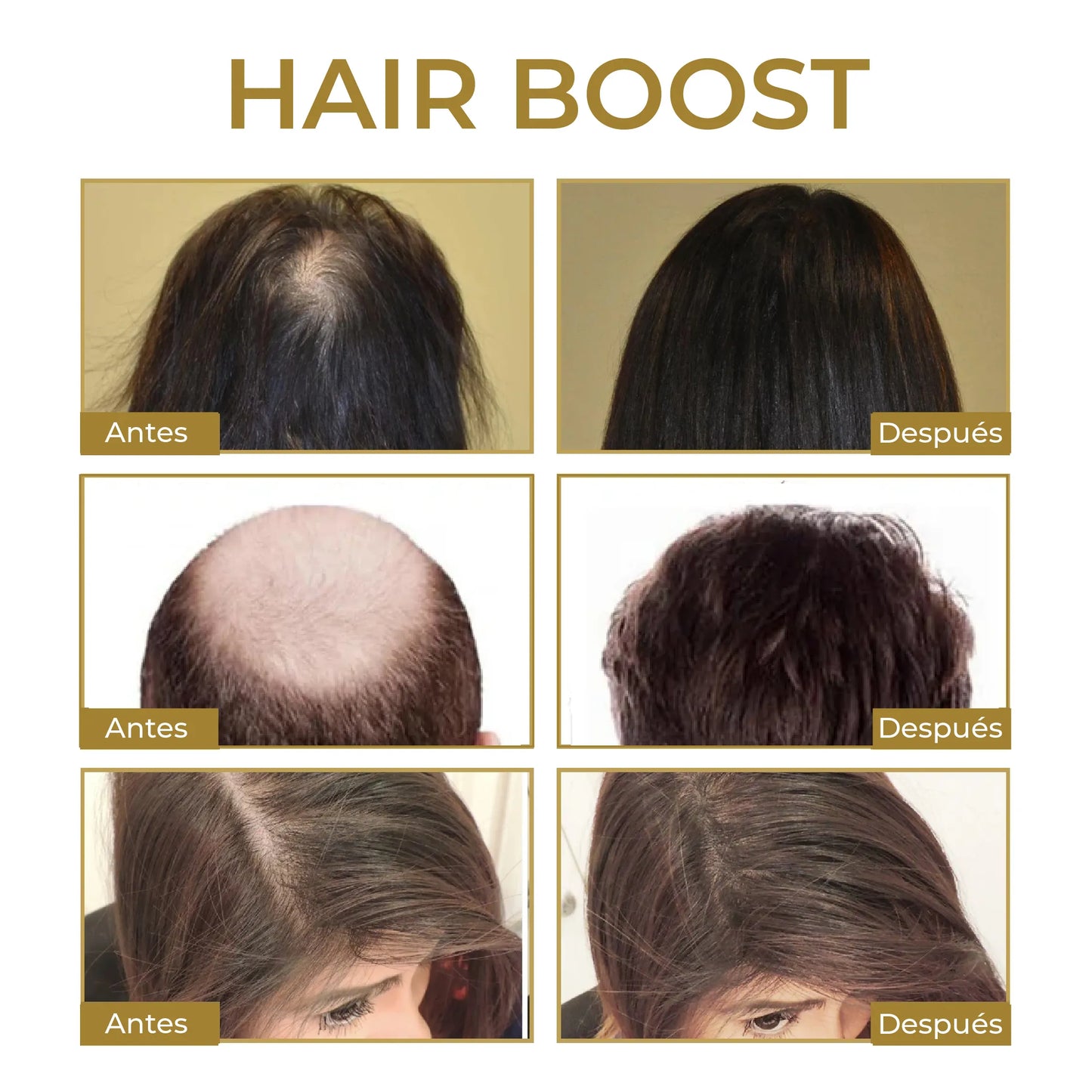 HairBoost: Crece, Fortalece y Anti Caida