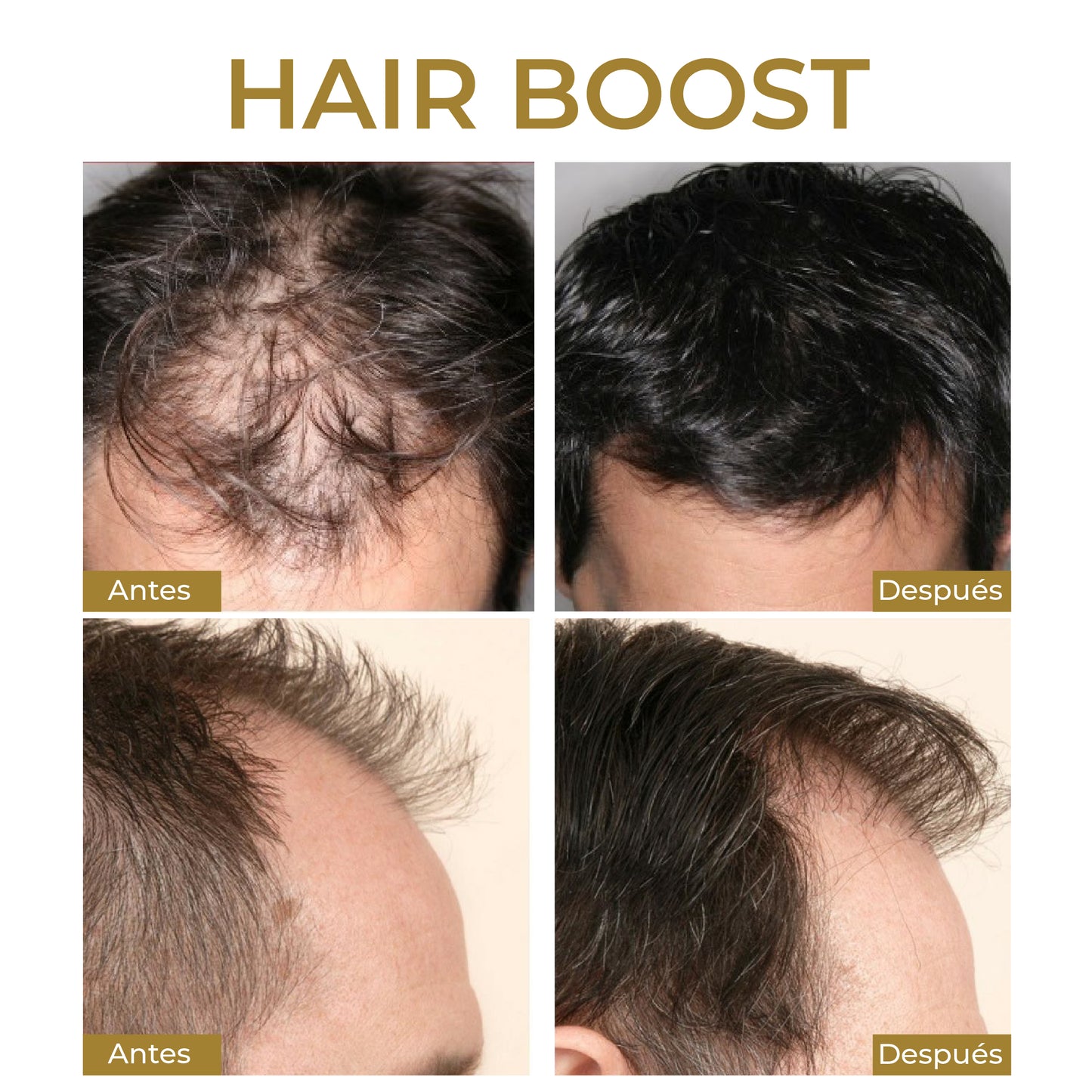 HairBoost: Fortalece y Combate la Calvicie
