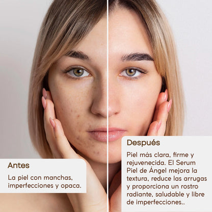 Serum Facial Piel de Angel + Obsequio